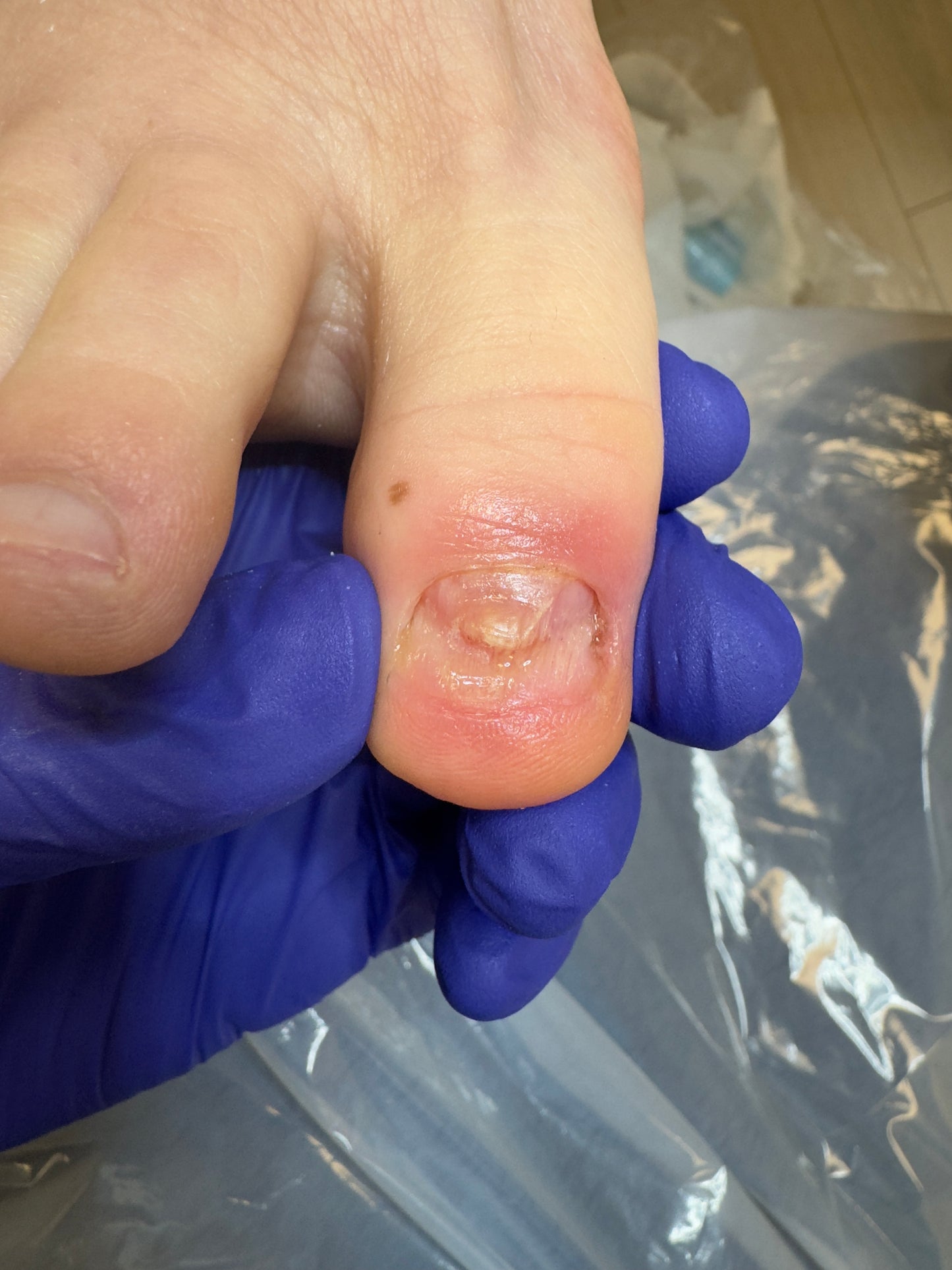Advanced pedicure course - skin and nail pathologies